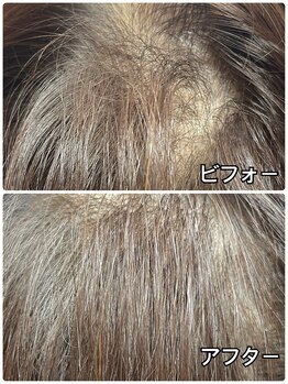 ソフィアアイズ 倉敷店(SOPHIAEYES)/エレガンスアップで頭髪を増毛