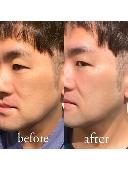 ベレカ(belleca)/男女問わず人気☆