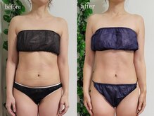 ティティビューティ ラ・クエージ金山(TTBeauty)/骨格別痩身