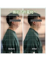 カルラ(KARURA)/まき肩猫背の原因は生活習慣に！