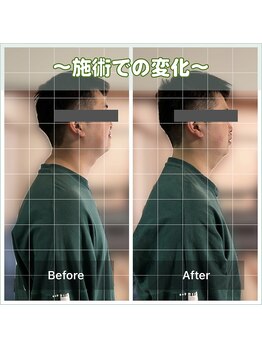 カルラ(KARURA)/まき肩猫背の原因は生活習慣に！