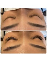 ニコリ(Nicori)/バインドロック