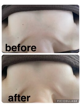 ギンザアール(GINZA R.)/バストケア♪