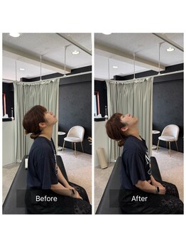 ナオル整体 広島福山院(NAORU整体)/肩こり/首こり→Before/After