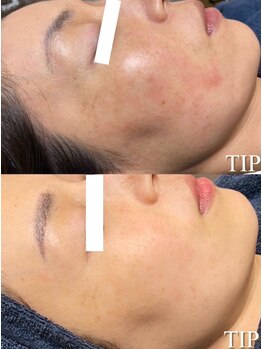 ラボーテエサンテ バイ ティアラ(la beaute et sante by Tiara)/様々なお肌悩みに◎