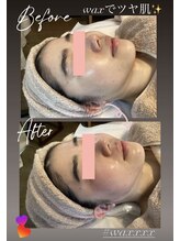 ソラ 六本松店(SORA)/お顔Wax