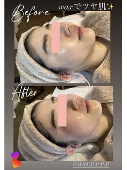 ソラ 六本松店(SORA)/お顔Wax