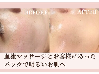 ハナハナ(hanahana)の写真