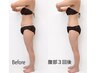 イタくない!針の要らない脂肪分解ボディー1パーツモニター¥22000→¥18000