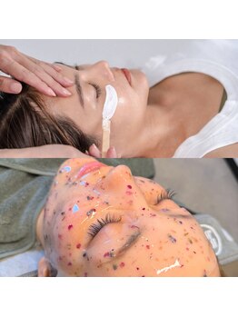 エルジェ(L.j)の写真/顔waxで産毛と顔ダニをオフし毛穴ケア！鎮静にはハイドロジェリーパックでスキンケア浸透率UPも期待☆