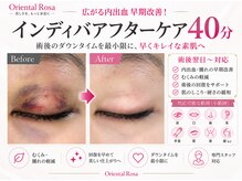 オリエンタルローザ 表参道(Oriental Rosa)/術後・けが・きずあとの色味改善