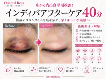 オリエンタルローザ 表参道(Oriental Rosa)/術後・けが・きずあとの色味改善