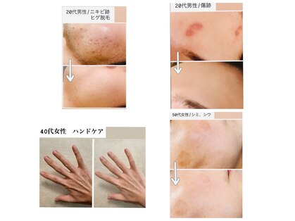 エクラボーテ 仙台新寺(Eclat beaute)の写真
