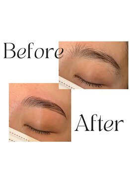 ヴィーナス アイビューティー(VENUS Eye Beauty)/ハリウッドブロウリフト