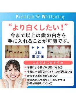 ホワイトニングカフェ イオン新潟青山店(WhiteningCafe)/★★歯科提携★★プレミアムWC