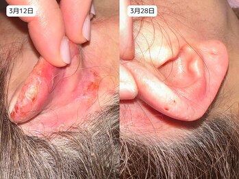 レイル(REIR)/ピュールボーテ/富士の不動水