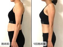 優子さんの美容矯正サロン