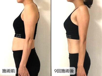 優子さんの美容矯正サロンの写真