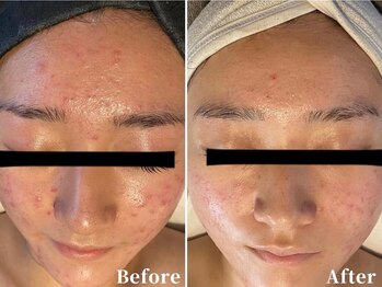 エープラス(A+)/コモデックス