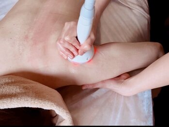 アダム(Adam)の写真/気になる二の腕のお肉を徹底ケア！気になる部分を集中的にケアをしてスッキリとした美ボディへ導きます♪