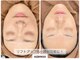 ビュー(Beau)の写真