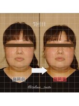 セリーヌ 国分寺店(seline)/小顔・筋膜リンパマッサージ