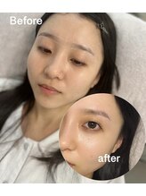 イム(im)/美眉スタイリング×まつ毛パーマ