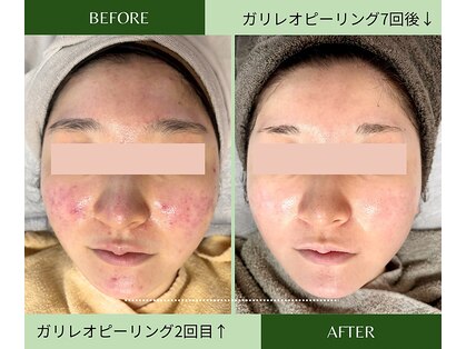 ルームエイトエイティスリー 新宿(R883)の写真