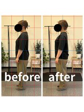 熊本カワル整体 JR上熊本駅院/ストレートネック、巻き肩