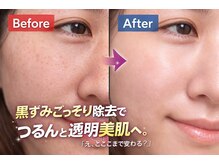 ナナ(Beauty Collection NANA)