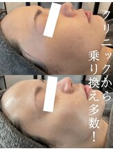 トップスキン 表参道(TOPSKIN)&nbsp;専門店だか らできる技