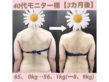 スワン 新栄店(SWAN)/40代モニター様/3カ月後の変化