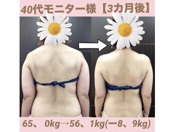 スワン 新栄店(SWAN)/40代モニター様/3カ月後の変化