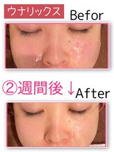 ウナ デ リンゴル 恵比寿店(UNA de Ringol)/サーマクール(ウナリックス)★