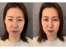 ルポナゴヤ(repos.nagoya)/【カラー＆顔タイプ診断】