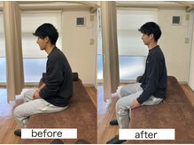 市川本八幡リーフ整骨院/ビフォーアフター/猫背姿勢改善