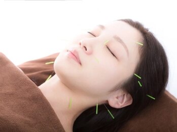 トゥーアズ シャロン(toAZ SHARON)の写真/大人気！鍼とマトリクスウェーブ（高周波電気）を組み合わせたプレミアム小顔矯正。イベント前におすすめ♪