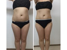 レミュー/ぽっこりお腹もメリハリくびれへ