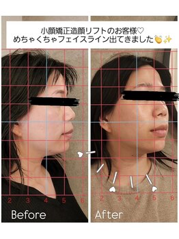 アンドモア(and MORE)/フェイスライン出現！！