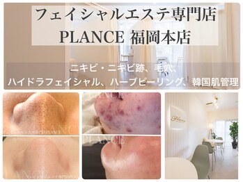 プランス 福岡(PLANCE)