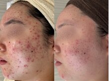 プライベートサロン ラウレア(Laule'a)/