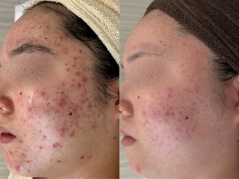 プライベートサロン ラウレア(Laule'a)/