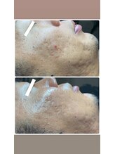 ラキ 所沢(Laki)/