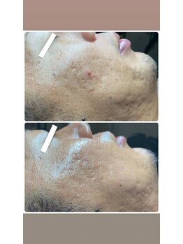 ラキ 所沢(Laki)/