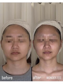 フロル(FLOR)/FLOR 【根本改善専門店】