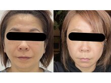 ビューティータワー(Beauty Tower)の雰囲気（年齢は止められない…でも印象は変えられる）