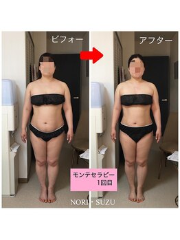 ノリスズ(NORI SUZU)/痩身・リフトUP・小顔・頭大きさ