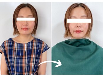 エピファニー 東京 銀座/ビフォーアフター30代(M.Y様)