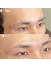 眉毛ハウス 吉祥寺店(眉毛HOUSE)/お客様の施術例(吉祥寺/東京)