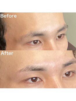 眉毛ハウス 吉祥寺店(眉毛HOUSE)/お客様の施術例(吉祥寺/東京)